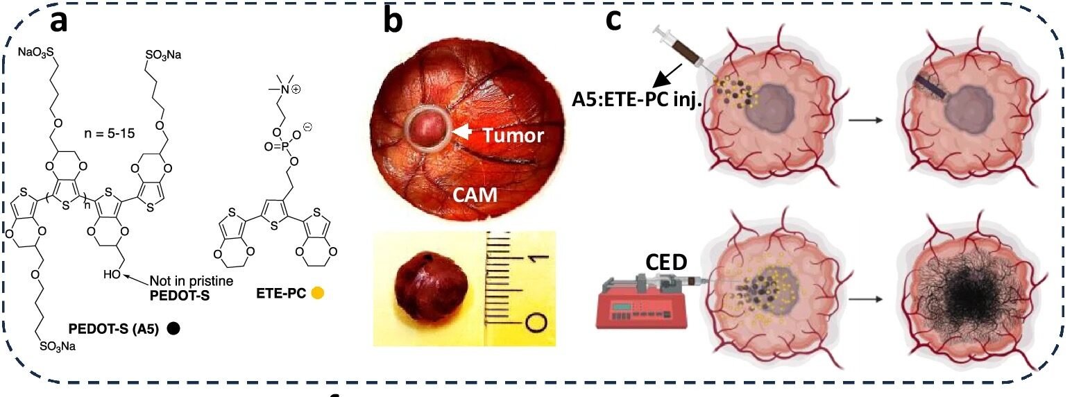 Electrotherapy Offers Hope for Glioblastoma Treatment - GizmoMD